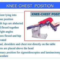 Position chest knee examination patient sigmoidoscopy rectum assumed physical health digital fig